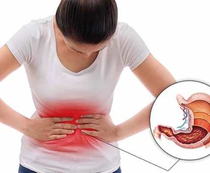 Viêm dạ dày mạn tính - Cách phân loại và phòng ngừa